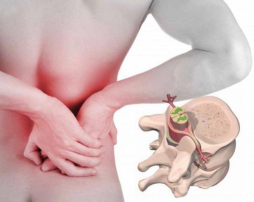 inzitan hernia discal tratamiento