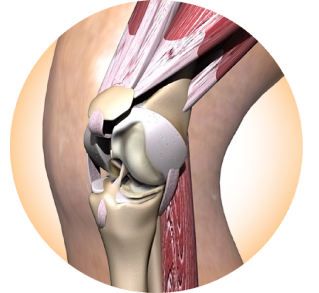 huesos - dolor - articulaciones