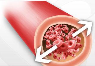 Dietas para hipertensos