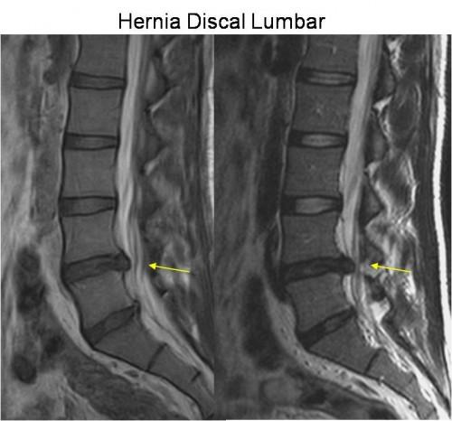 resonancia magnética