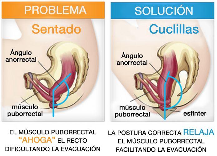 Postura correcta estreñimiento