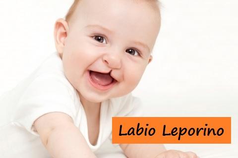 Labio Leporino en los Bebé.