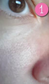 antes de ponerme el Steam Balm