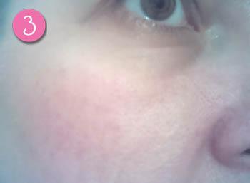 despues del Steam Balm