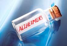paciente de Alzheimer