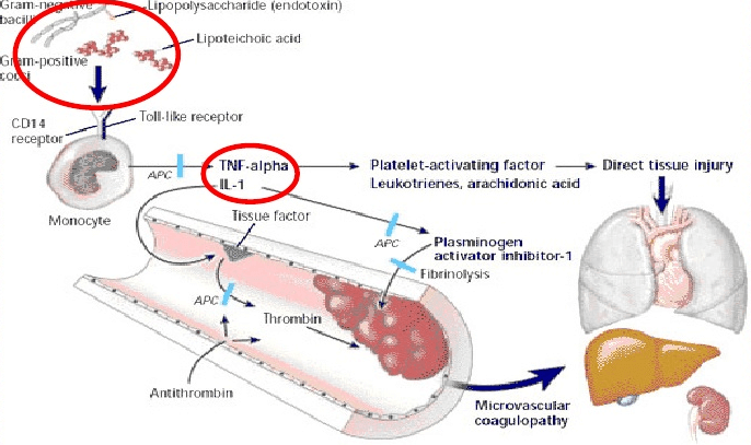 Fisiopatología-sepsis