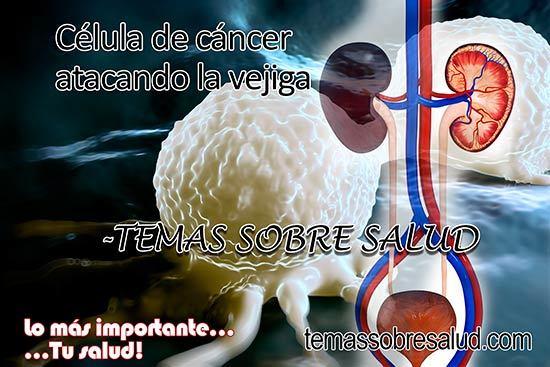 cáncer de vejiga