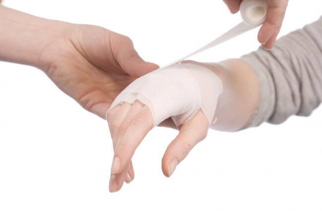 como tratar las quemaduras