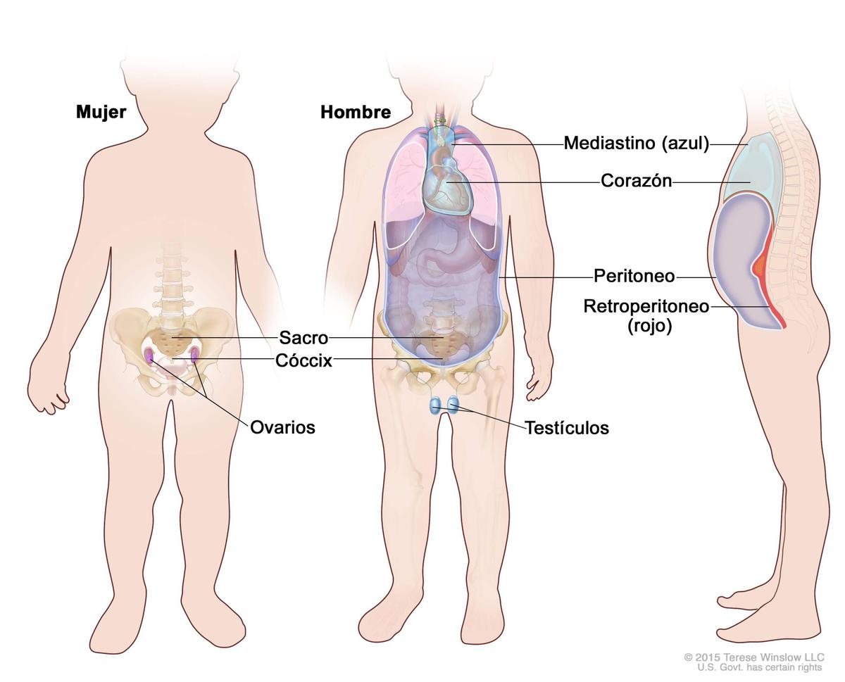 Neoplasias de las gónadas y de células germinales