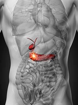 Pancreas-y-vesicula-biliar
