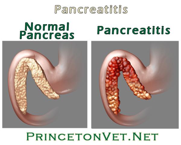 inflamacion del pancreas