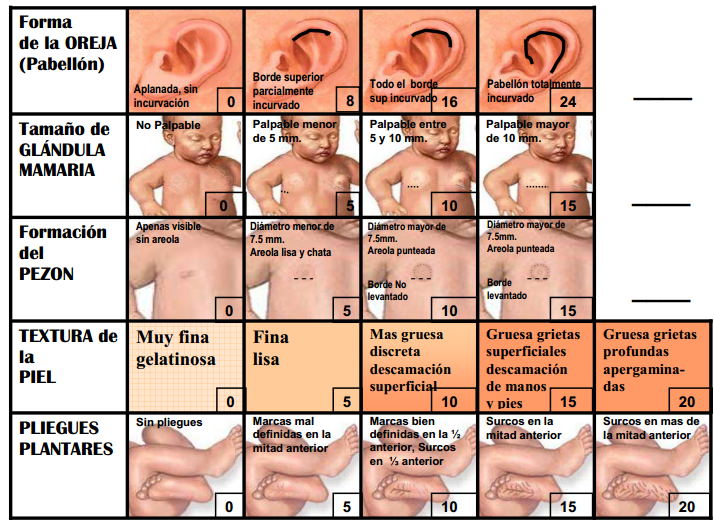 Recién nacido-Capurro