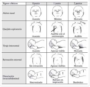 Recién nacido-Silverman
