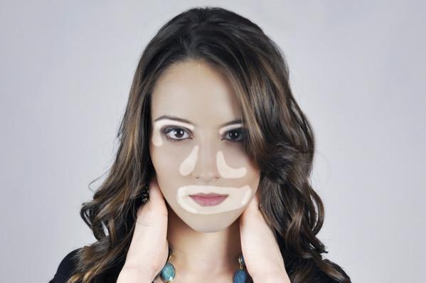 modelo-vitiligo