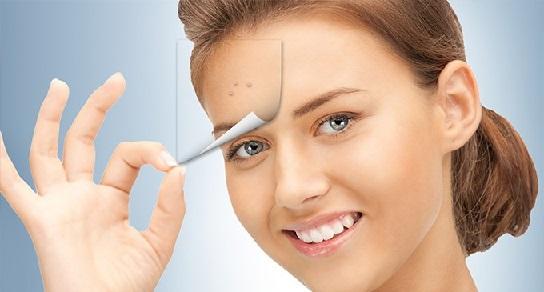 hay varios remedios para eliminar el acné