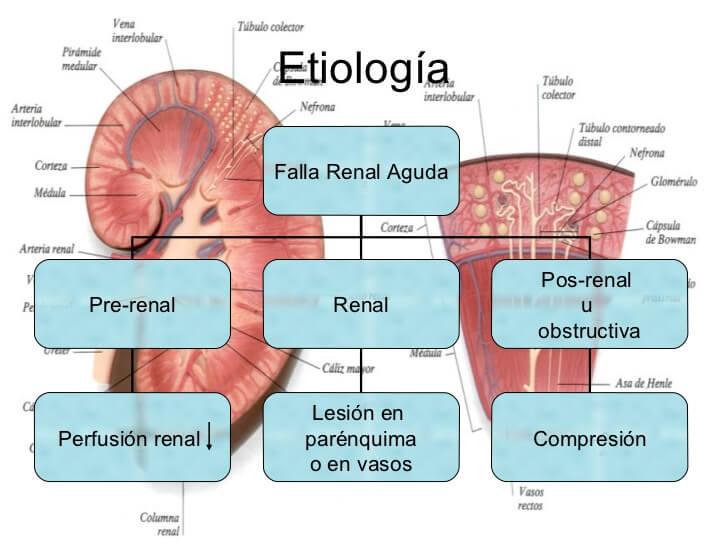 Falla renal aguda 3-Causas