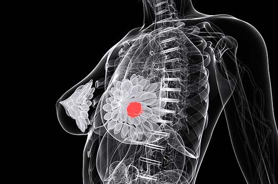 cánceres más mortíferos