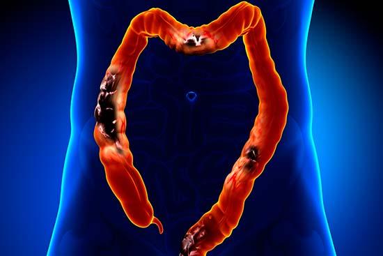 cánceres más mortíferos