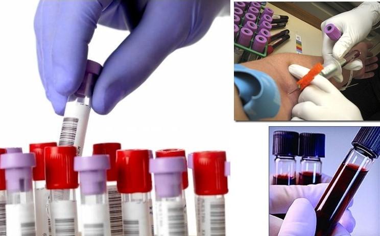 análisis de sangre