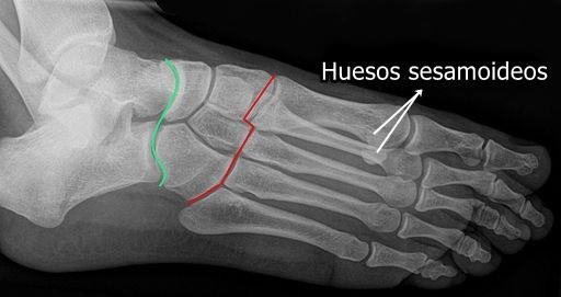 Huesos sesamoideos del pie