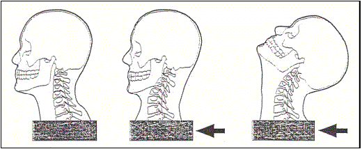 Ejercicios para las cervicales