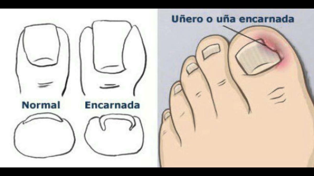 pedicura444