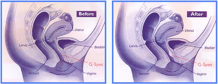 ginecoestetica-ginecoestticalo-nuevo-en-tratamientos-de-ciruga-esttica
