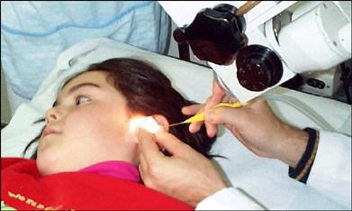 Cera en los oídos, esto es lo que no debes hacer