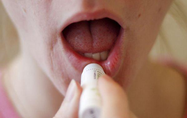 labios resecos solucion