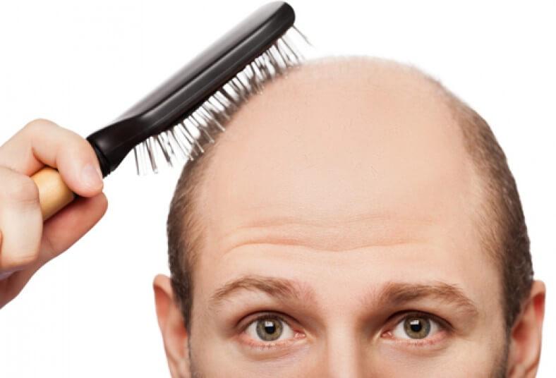 Tratamientos para la caída del cabello