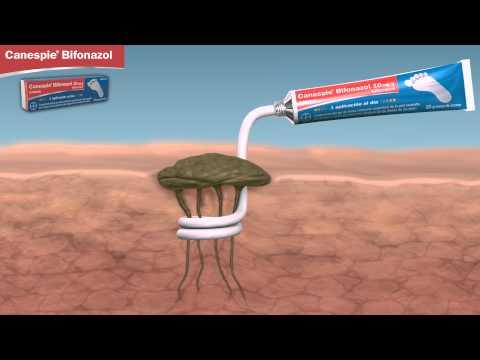 clotrimazol (Canesten®), bifonazol (Cansespie®), tolnaftato o miconazol Tiña, pie de atleta