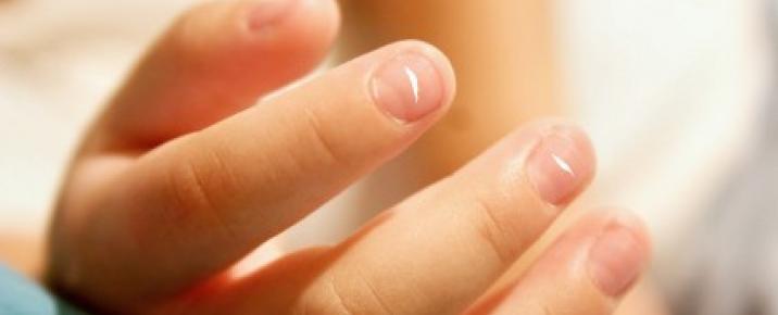 ¿Porque las manchas blancas en las uñas?