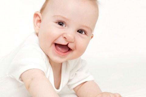 Labio leporino. Ácido fólico