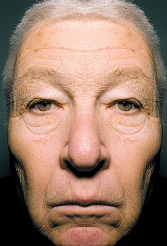 Envejecimiento cronológico