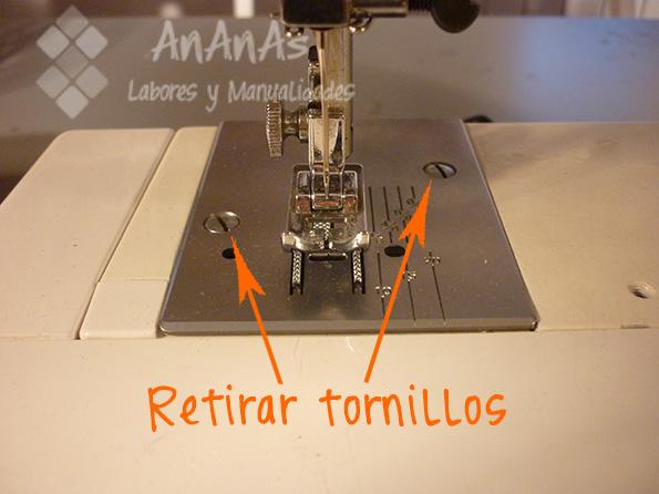 limpieza-placa-aguja