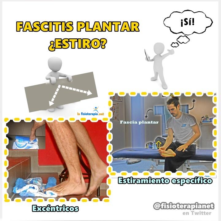 Estiramientos para fascitis plantar