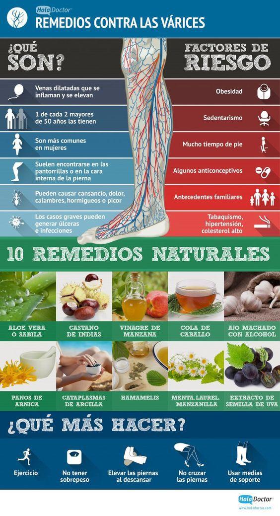¿Qué son las varices y cómo se pueden combatir? #remedios #varices #infografía: 