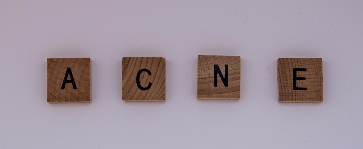 acne-barros-espinillas-manchas