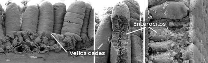 ciclo-intestino-permeable