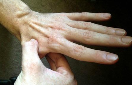 punto de presion en la mano para aliviar la espalda