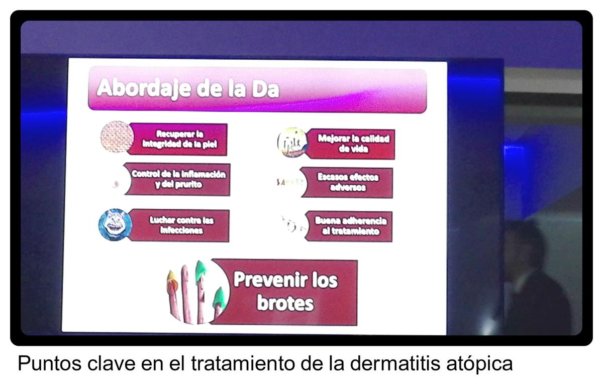 dermatitis atópica