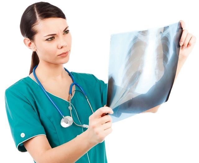 Radiografía en el diagnóstico del cáncer pulmonar