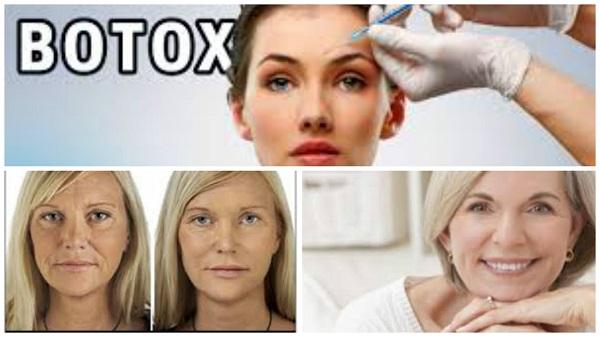 Cirugia con Botox