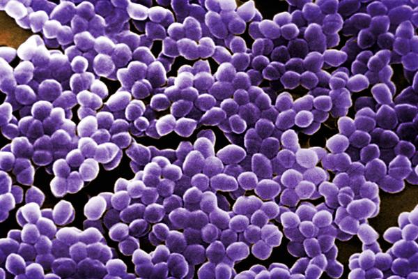 bacterias gram-positivas