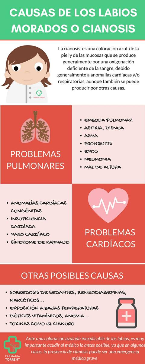 Infografía causas cianosis o labios morados