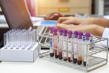 anemia hemolitica 051