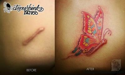Ocultar las Cicatrices con Tatuajes