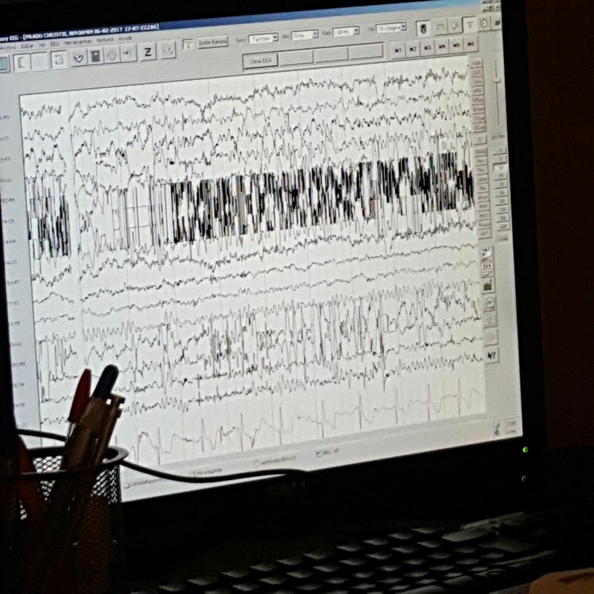 estudio-terrores-nocturnos