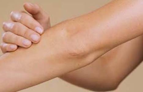 cuidado de codos y rodilla