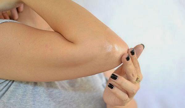 Como-Aclarar-Los-Codos-y-Rodillas-Naturalmente